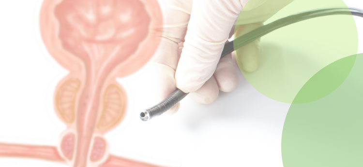 軟性膀胱鏡による検査の実施